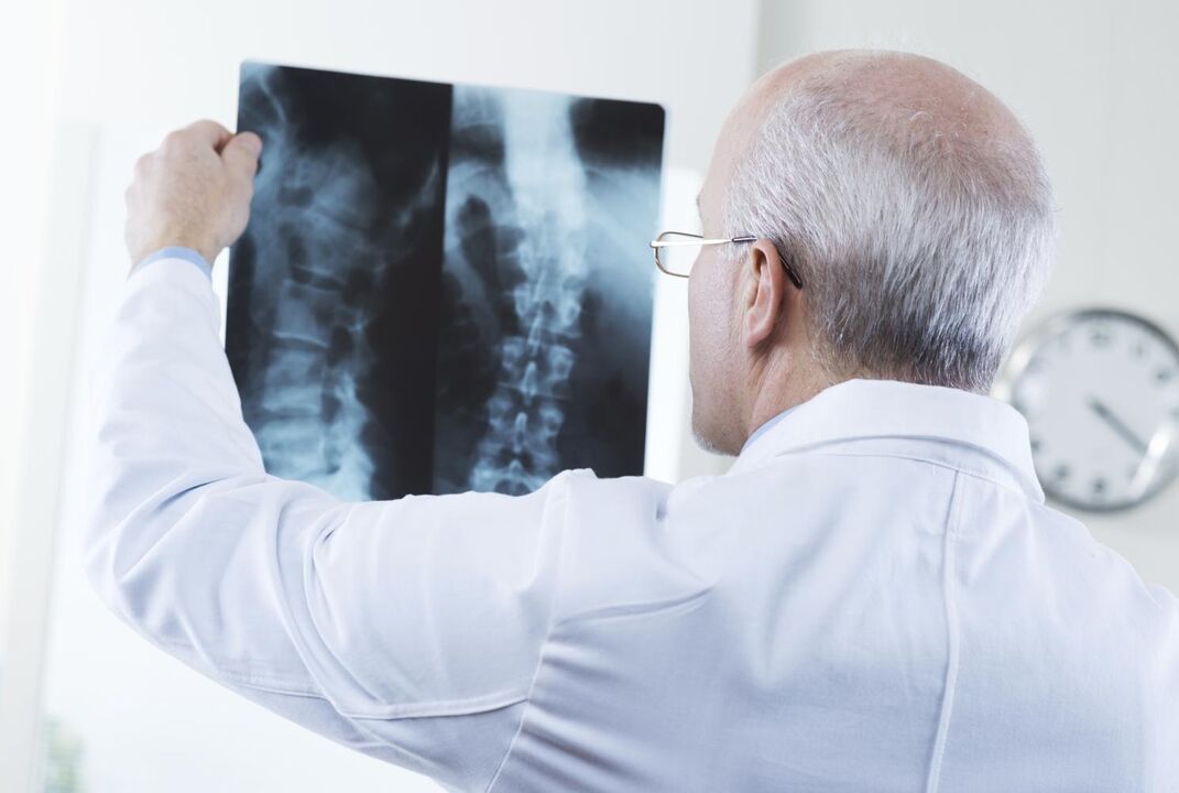 a nyaki gerinc osteochondrosisa kezelőorvos